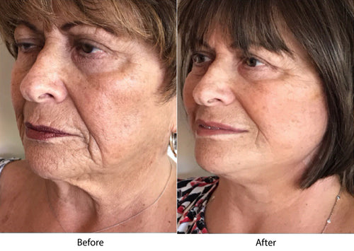 Velvra 7-in-1 facial massage and introduction device