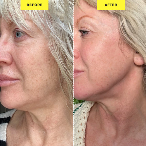 Velvra 7-Mode LED Beauty Device Plus